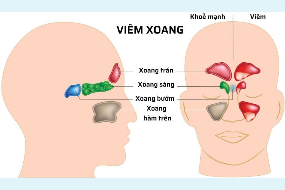 Vị trí của các xoang