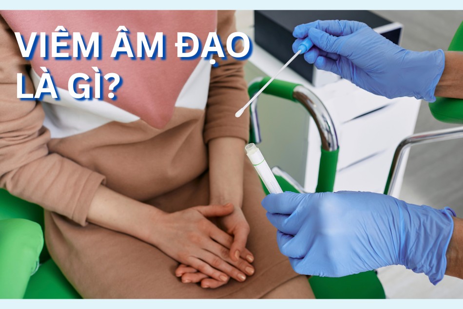 Cảnh báo sức khỏe: 5 dấu hiệu viêm nhiễm âm đạo chị em không nên chủ quan