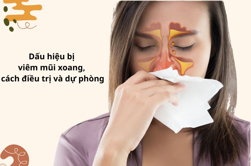 Viêm mũi xoang là bệnh lý gì? Dấu hiệu khi bị viêm mũi xoang, cách điều trị và dự phòng